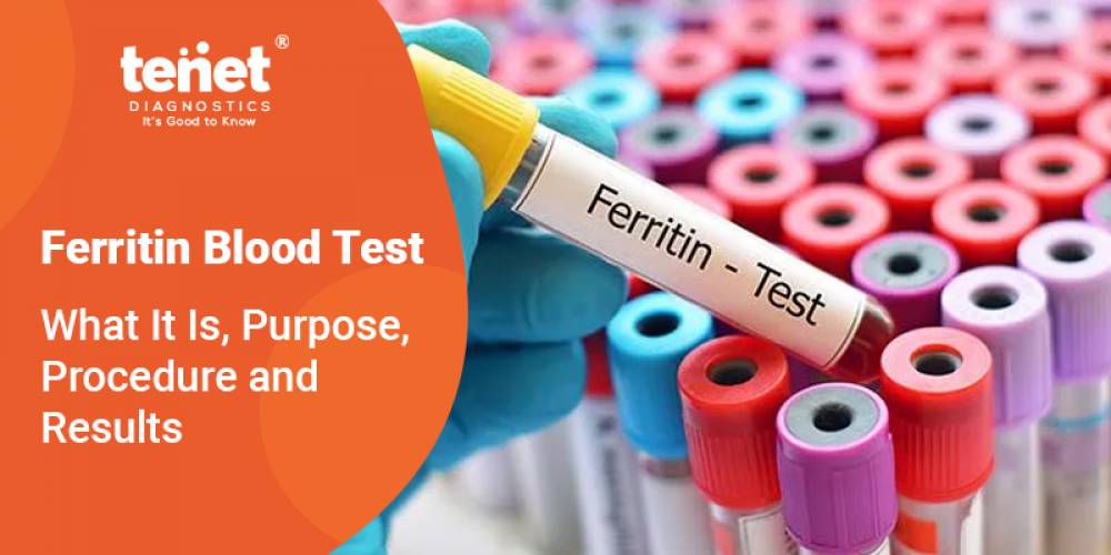 Ferritin Blood Test: What It Is, Purpose, Procedure and Results image