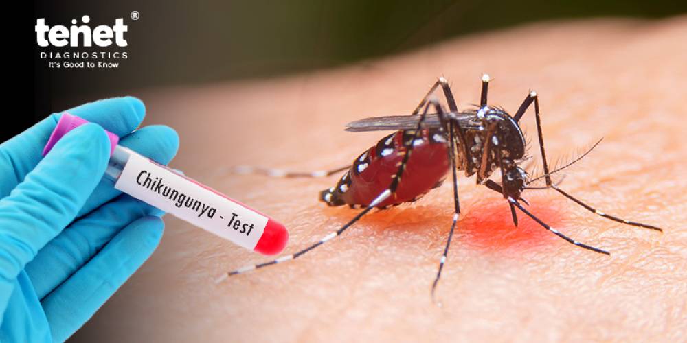 What is Chikungunya fever, and how should I diagnose it?