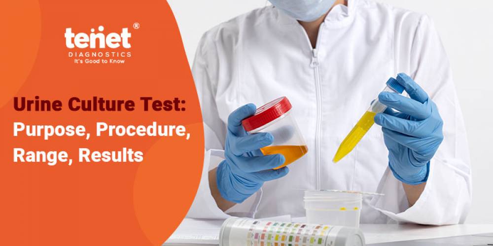 Urine Culture Test: Purpose, Procedure, Range, Results image
