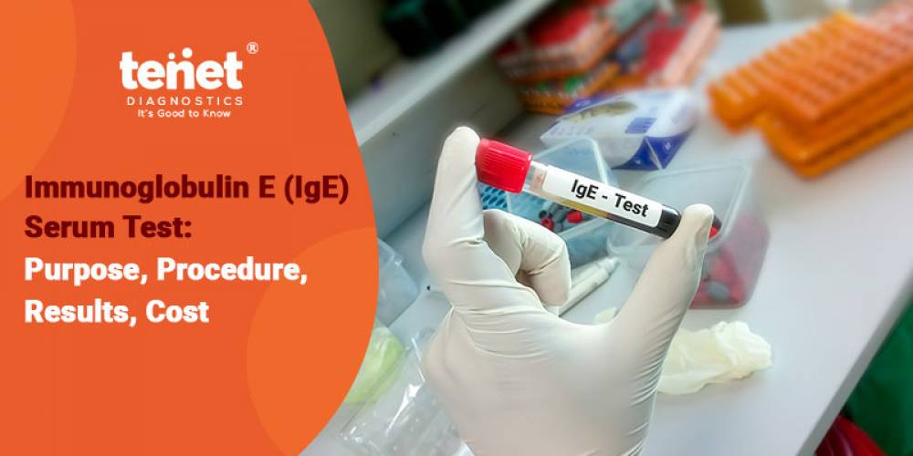 Immunoglobulin E (IgE) Serum Test: Purpose, Procedure, Results, Cost image