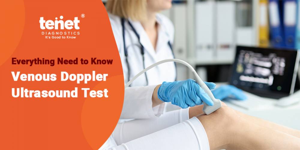 Everything Need to Know Venous Doppler Ultrasound Test image