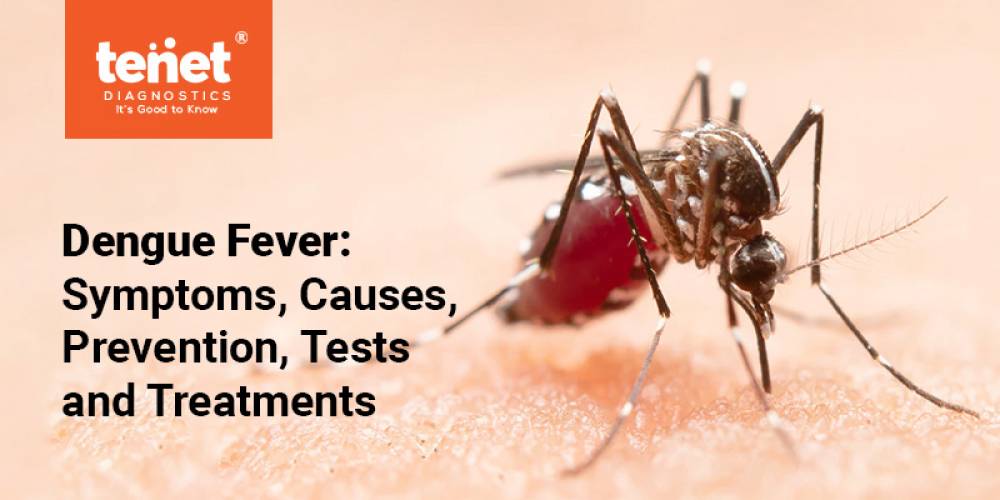Dengue Fever: Symptoms, Causes, Prevention, Tests, and Treatments image
