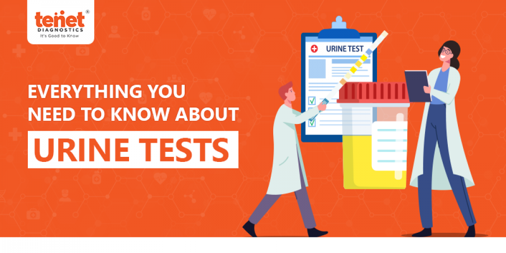 Everything You Need To Know About Urine Tests