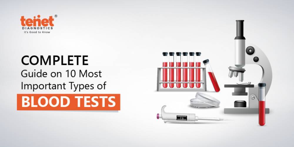 How Many Different Types Of Blood Tests Are There