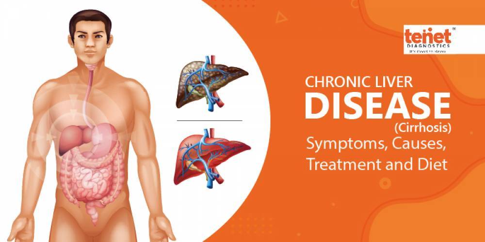 Can You Live With Chronic Liver Disease