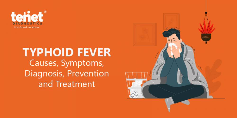 What is the Diagnosis and Treatment for Typhoid Fever? | The Causes, Symptoms, and Prevention. image