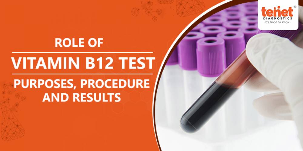Role of Vitamin B12 Test:  Purposes, Procedure and Results image