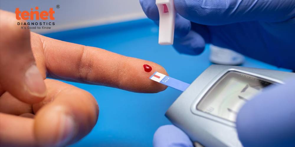 A Comprehensive Guide on Diabetes and Profile Tests for Early Diagnosis image