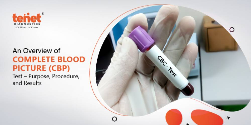 An Overview of Complete Blood Picture (CBP) Test – Purpose, Procedure, and Results. image