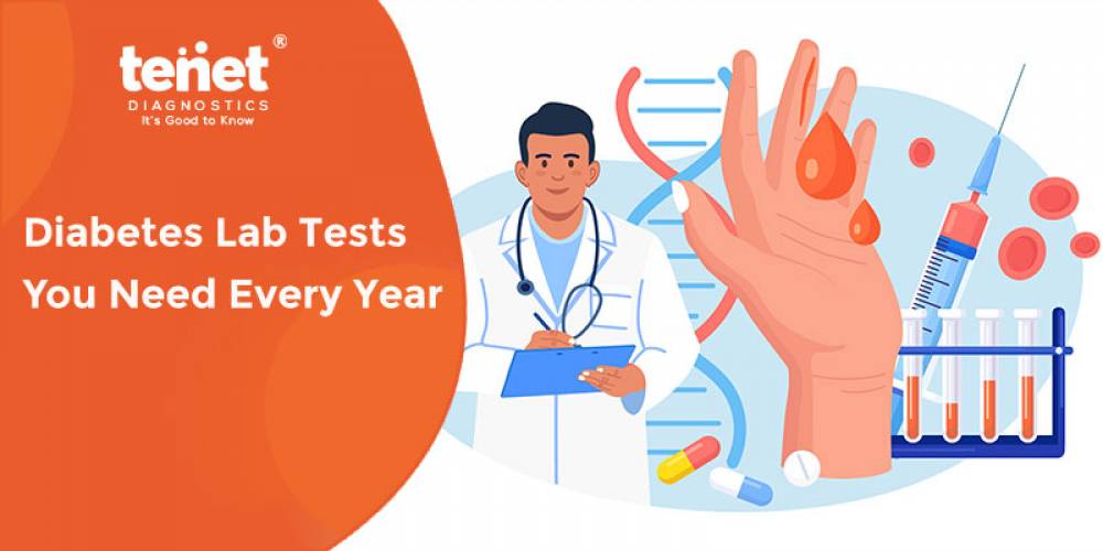 Diabetes Lab Tests You Need Every Year image