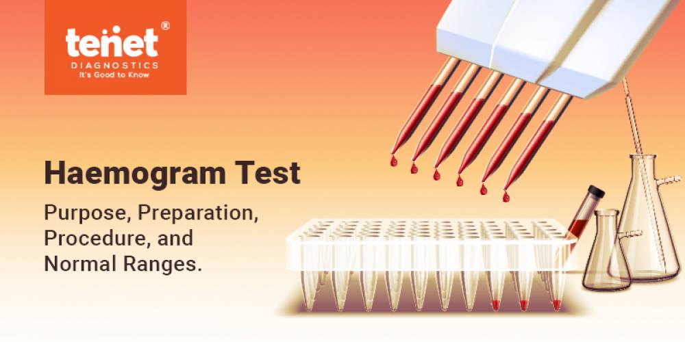 A Complete Guide On Haemogram Test