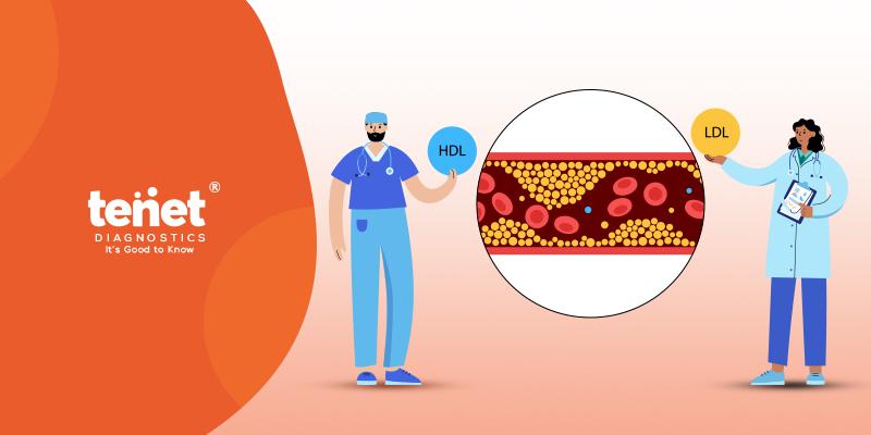 Purpose of Cholesterol Test