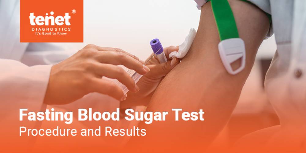 Fasting Blood Sugar Test - Procedure and Results image